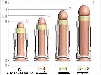 Результаты увеличения члена при использовании экстендера